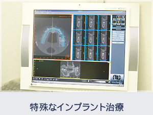 特殊なインプラント治療